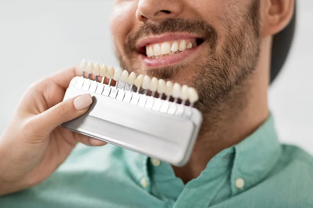 How Much Do Veneers Cost? Full Breakdown of Prices & Factors Veneers cost